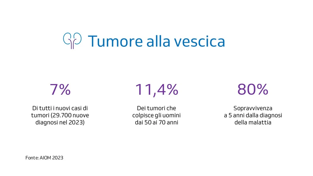 Tumore alla vescica